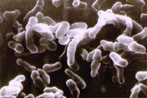 プロピオニバクテリウム・アクネス菌