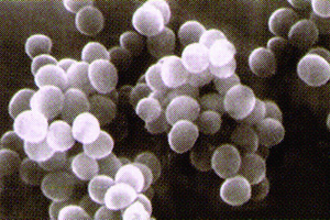 スタフィロコッカス・エピデルミディス菌