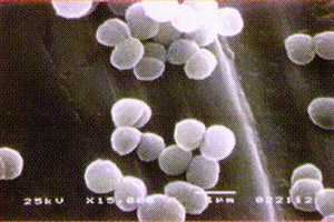 ミクロコッカス属